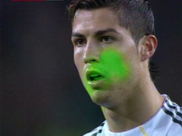 Cristiano Ronaldo, le laser ça commence à bien faire